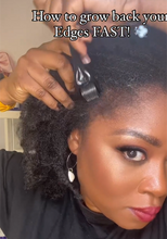 Load image into Gallery viewer, Hair Growth Derma Roller