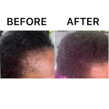 Load image into Gallery viewer, Before and After: Anoint - Hair Growth Oil For Edges & Thinning Areas - Full Bloom Beauty